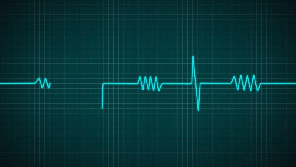 Rytmy do defibrylacji i ich znaczenie w leczeniu migotania komór