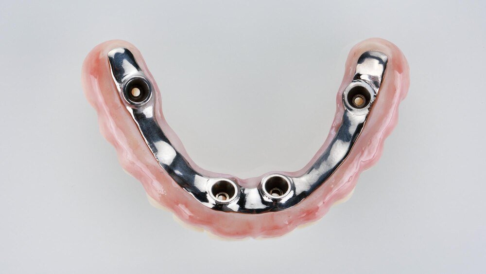 Ile kosztuje aparat rozszerzający szczękę – ceny i możliwości refundacji